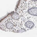 Immunohistochemical staining of human colon shows moderate nuclear positivity in glandular cells.