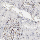 Immunohistochemical staining of human kidney moderate nuclear positivity in cells in glomeruli.