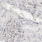 Immunohistochemical staining of human kidney moderate nuclear positivity in cells in glomeruli.