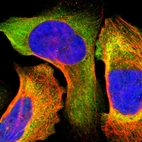 Immunofluorescent staining of human cell line U-2 OS shows localization to cytosol.