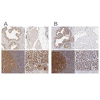 Immunohistochemical staining of human prostate, skeletal muscle, tonsil and upper gastrointestinal using Anti-PRKCD antibody HPA001863 (A) shows similar protein distribution across tissues to independent antibody HPA001890 (B).