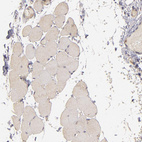 Anti-PRKCD Antibody