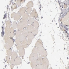 Immunohistochemical staining of human skeletal muscle shows only very weak cytoplasmic positivity in myocytes.