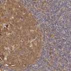 Anti-PRKCD Antibody