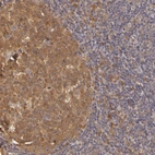Immunohistochemical staining of human tonsil shows strong cytoplasmic positivity in germinal center cells.