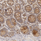 Immunohistochemical staining of human upper gastrointestinal shows moderate cytoplasmic positivity in glandular cells.
