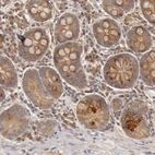 Immunohistochemical staining of human upper gastrointestinal shows moderate cytoplasmic positivity in glandular cells.
