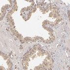 Immunohistochemical staining of human prostate shows moderate cytoplasmic positivity in glandular cells.