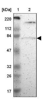 Lane 1: Marker [kDa] 220, 112, 84, 47, 32, 26, 17_br/_Lane 2: Human cell line RT-4