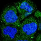 Immunofluorescent staining of human cell line A-431 shows localization to cytosol.