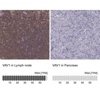 Anti-VAV1 Antibody