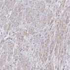 Anti-VAV1 Antibody