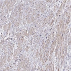 Immunohistochemical staining of human prostate shows weak cytoplasmic positivity in smooth muscle cells.