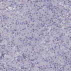 Anti-VAV1 Antibody