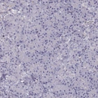 Immunohistochemical staining of human pancreas shows no positivity in exocrine glandular cells as expected.