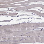Immunohistochemical staining of human skeletal muscle shows no positivity in myocytes as expected.