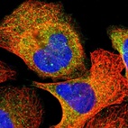 Immunofluorescent staining of human cell line U-2 OS shows localization to cytosol.