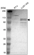 Western blot analysis in human cell line RT-4 and human cell line U-251 MG.