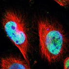 Immunofluorescent staining of human cell line U-251 MG shows localization to nucleoplasm.