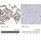 Anti-PRX Antibody