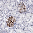 Immunohistochemical staining of human kidney shows strong membranous positivity in cells in glomeruli.
