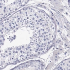Immunohistochemical staining of human testis shows no positivity in cells in seminiferous ducts as expected.