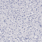 Anti-PRX Antibody