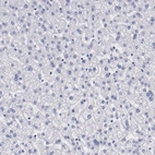 Immunohistochemical staining of human liver shows no positivity in hepatocytes as expected.