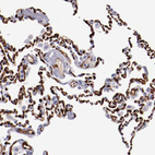 Immunohistochemical staining of human lung shows strong membranous positivity in pneumocytes.
