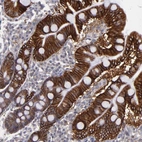 Immunohistochemical staining of human duodenum shows strong cytoplasmic positivity in glandular cells.