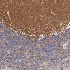 Anti-FAT1 Antibody