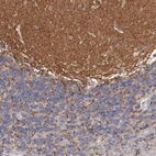 Immunohistochemical staining of human cerebellum shows strong cytoplasmic positivity in granular layer.
