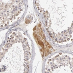 Immunohistochemical staining of human testis shows low expression as expected.