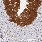 Immunohistochemical staining of human urinary bladder shows high expression.