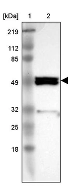 Lane 1: Marker [kDa] 219, 112, 85, 49, 32, 25, 18_br/_Lane 2: Human cell line RT-4