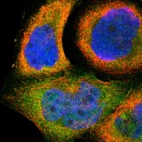 Immunofluorescent staining of human cell line A-431 shows localization to cytosol.