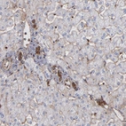 Anti-ACTN4 Antibody