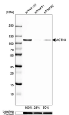 Western blot analysis in A-549 cells transfected with control siRNA, target specific siRNA probe #1 and #2, using Anti-ACTN4 antibody. Remaining relative intensity is presented. Loading control: Anti-GAPDH.