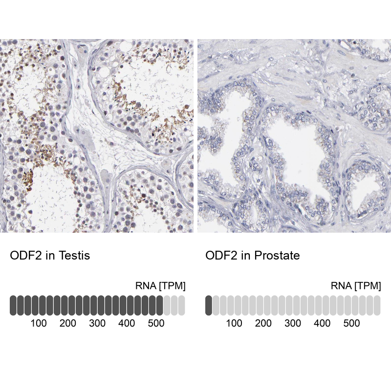 Anti-ODF2 Antibody