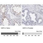 Anti-ODF2 Antibody