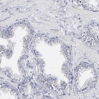 Immunohistochemical staining of human prostate shows low expression as expected.