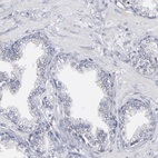 Anti-ODF2 Antibody