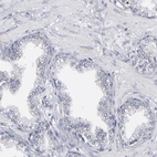 Immunohistochemical staining of human prostate shows low expression as expected.