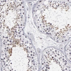 Immunohistochemical staining of human testis shows high expression.