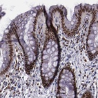 Anti-CHEK2 Antibody