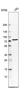 Anti-CHEK2 Antibody