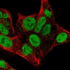 Immunofluorescent staining of human cell line Hep G2 shows localization to nucleoplasm & the Golgi apparatus.