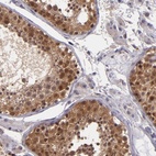 Anti-TAF7L Antibody