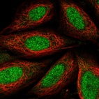 Immunofluorescent staining of human cell line SiHa shows localization to nucleoplasm.
