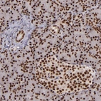 Anti-PQBP1 Antibody